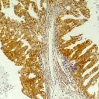 CXCR4 Antibody
