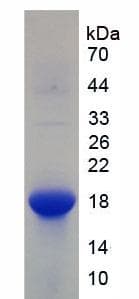 Human SNCA / Alpha-Synuclein Protein (Recombinant His, N-Terminal)