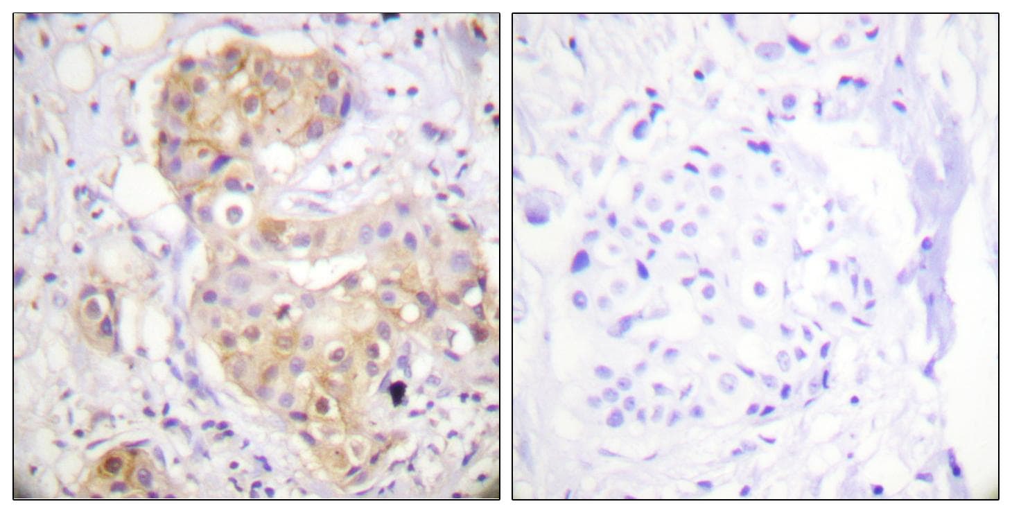 PRKCD / PKC-Delta Antibody (p505)