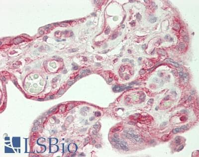 PathPlus™ CTNND1 / p120 Catenin Antibody (aa75-125)
