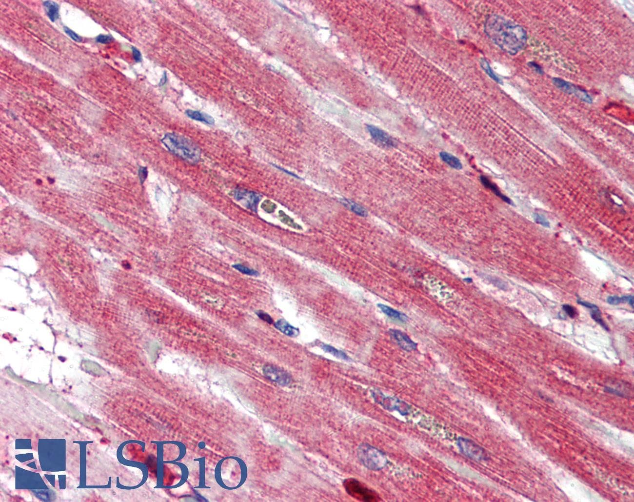 IHC-plus™ S100A4 / FSP1 Antibody