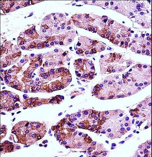 Polyclonal Rabbit anti-Human AGR2 Antibody (aa11-39, IHC, IF, WB)