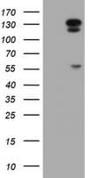 NNA1 / AGTPBP1 Antibody (clone OTI9D11)