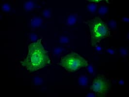 MCL1 / MCL 1 Antibody (clone OTI10F6)