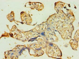 Polyclonal Rabbit anti-Human ATG9B Antibody (aa715-924, IHC)