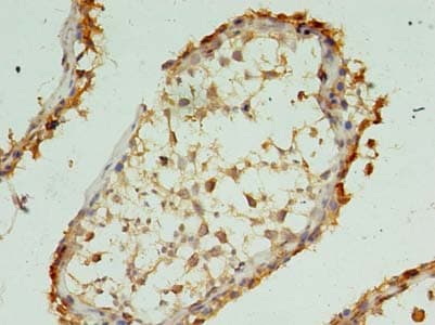 XAGE1E Antibody