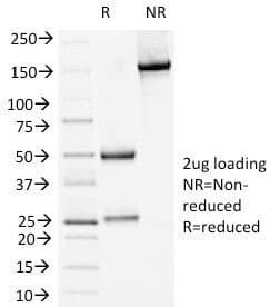 DSG1 / Desmoglein 1 Antibody (clone 18D4)