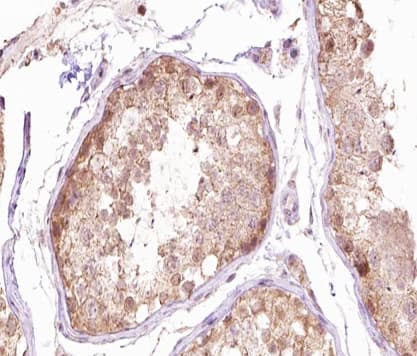 TUBG1 / Tubulin Gamma 1 Antibody