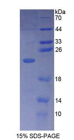 Human PLCB1 / Phospholipase C Beta 1 Protein (Recombinant His-T7)