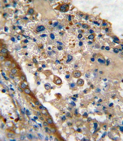 Polyclonal Rabbit anti-Human LRRC32 Antibody (aa234-260, IHC, WB)