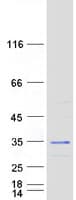 Human SCO1 Protein (Recombinant Myc-DDK (Flag))