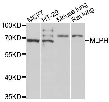 Polyclonal Rabbit anti-Human MLPH / Melanophilin Antibody (IHC, WB)