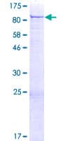 Human PRKCB / PKC-Beta Protein (Recombinant GST)