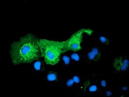 P5CR2 / PYCR2 Antibody (clone OTI2A5, Carrier-free)
