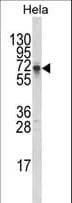Polyclonal Rabbit anti-Human DTX1 / Deltex Antibody (aa382-410, IHC, WB)