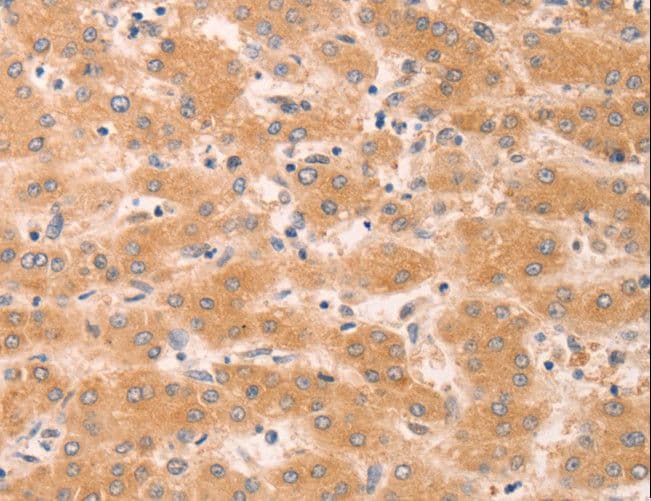 GNA11 Antibody