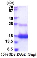 Human E48 / LY6D Protein (Recombinant His)