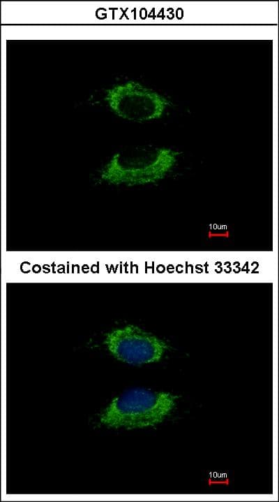 IHC-plus™ AK4 / Adenylate Kinase 4 Antibody (aa1-209)