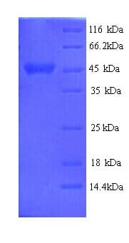 E. coli pntA Protein (Recombinant His)