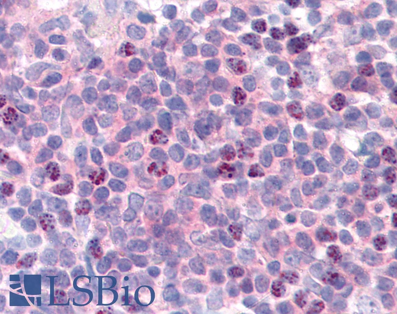 IHC-plus™ CCNL1 / Cyclin L1 Antibody (aa314-369)