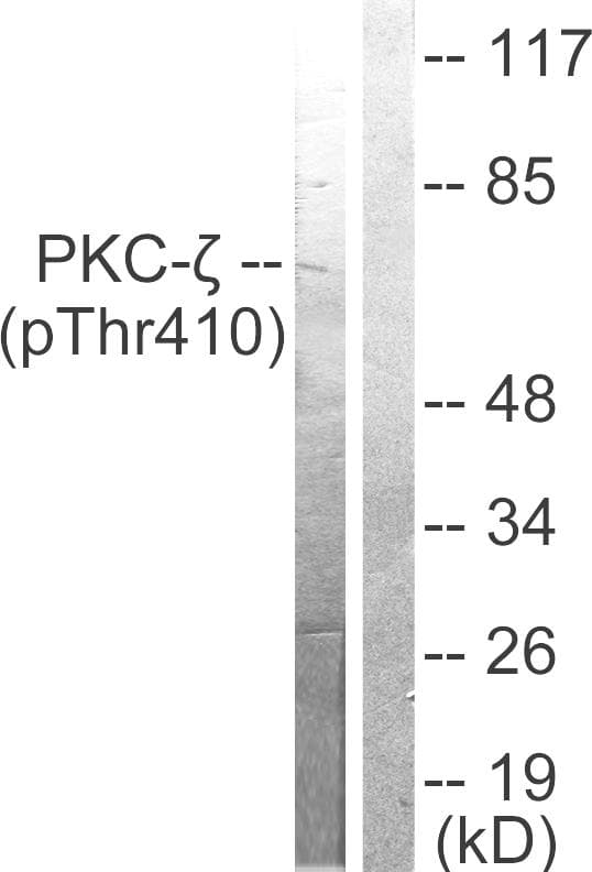 PRKCZ / PKC-Zeta Antibody (phospho-Thr410)