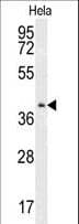 CMPK2 Antibody (aa142-170)