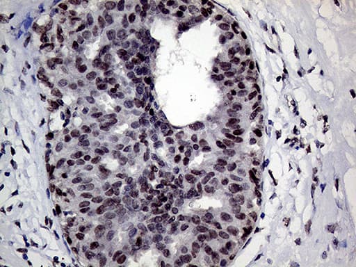 Monoclonal Mouse anti-Human RING1 Antibody (clone OTI2D11, aa88-362, IHC, WB)