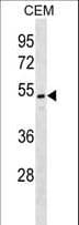 Polyclonal Rabbit anti-Human ONECUT2 / OC2 Antibody (aa102-130, WB)
