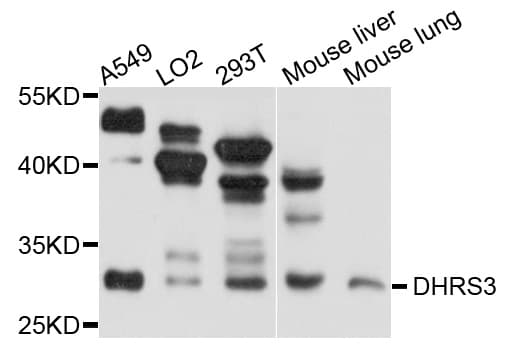 Polyclonal Rabbit anti-Human DHRS3 / SDR1 Antibody (IHC, WB)