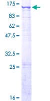 Human CHPF2 / CSGLCAT Protein (Recombinant GST)