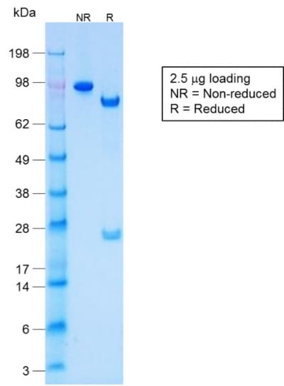 KRT77 / Keratin 77 / KRT1B Antibody (clone KRTL/1577R)