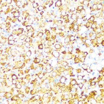 Polyclonal Rabbit anti-Human NAMPT / Visfatin Antibody (IHC, IF, WB)
