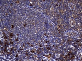 Monoclonal Mouse anti-Human TS / Thymidylate Synthase Antibody (clone 10F12, Carrier-free, IHC, WB)