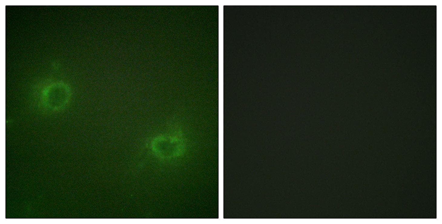 Polyclonal Rabbit anti-Human MRLC2 / MYL12B Antibody (IHC, IF)