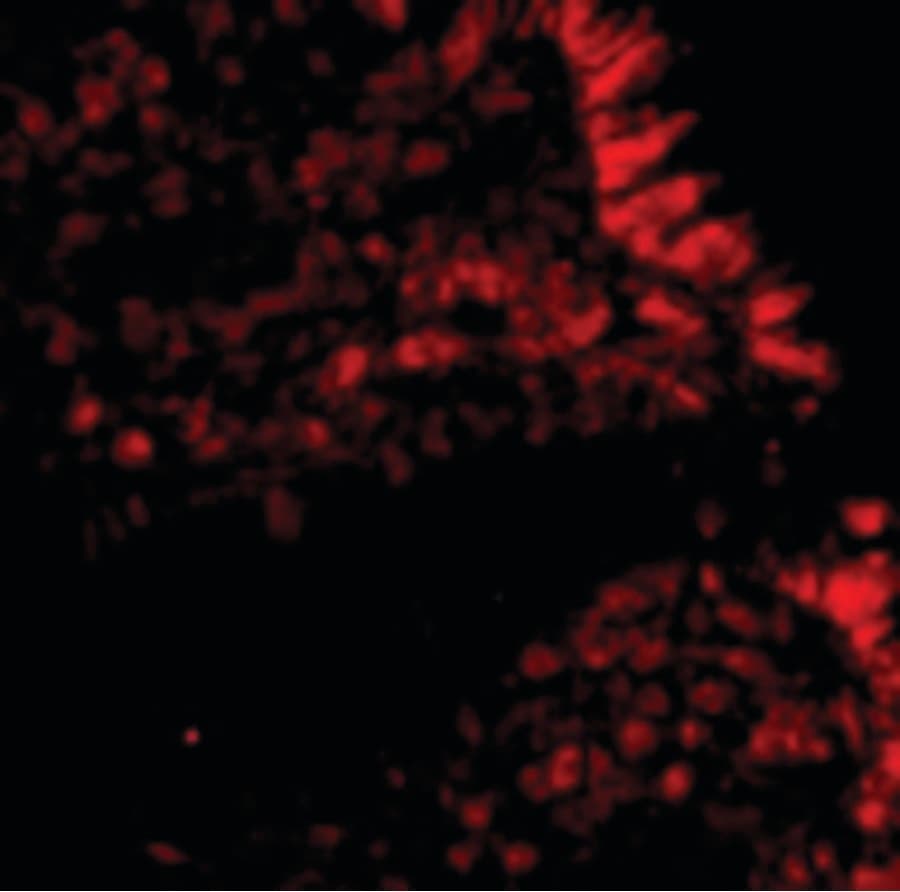 MICA Antibody