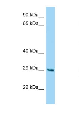 FAM122B Antibody (aa85-134)