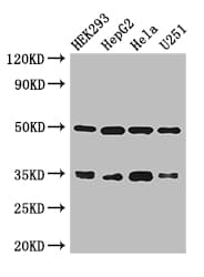 Polyclonal Rabbit anti-Human LZTFL1 Antibody (IHC, IF, WB)