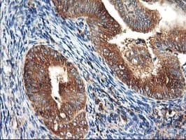 HARS2 Antibody (clone OTI3F1)