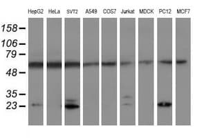 PSMB9 Antibody (aa21-219, clone OTI1F10, Carrier-free)