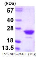 Human RGS10 Protein (Recombinant His)