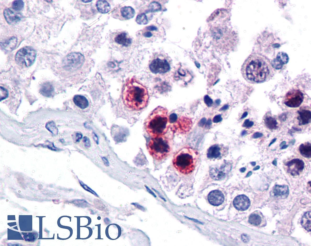 Polyclonal Rabbit anti-Human RORC / ROR Gamma Antibody (aa110-159, IHC, WB)