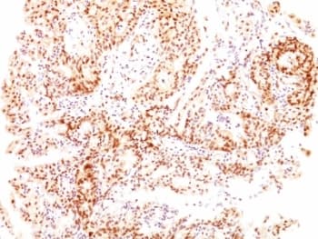 ESR2 / ER Beta Antibody (C-Terminus, clone ESR2/686, Ready-to-Use)