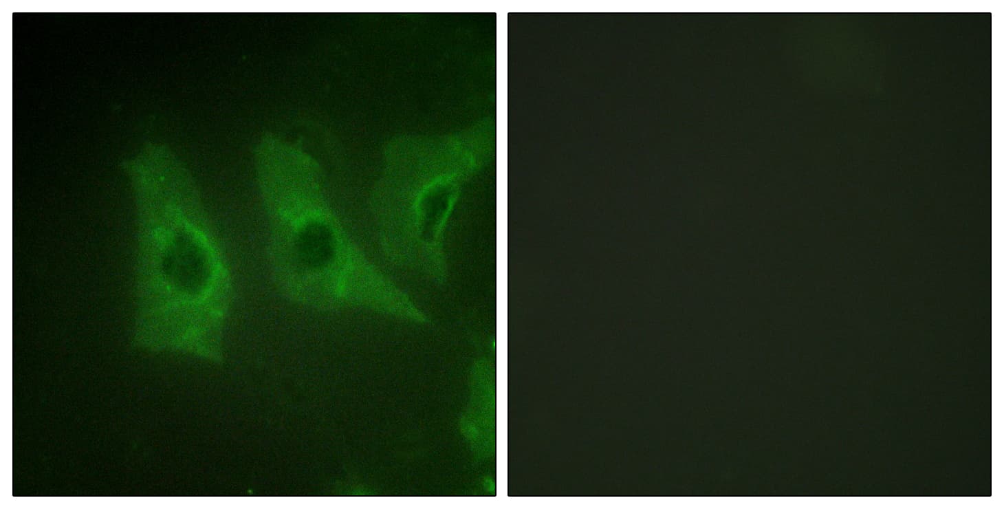Polyclonal Rabbit anti-Human CSNK1A1 / CK1 Alpha Antibody (aa287-336, IF, WB)