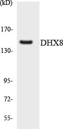Polyclonal Rabbit anti-Human DHX8 Antibody (aa376-425, WB)