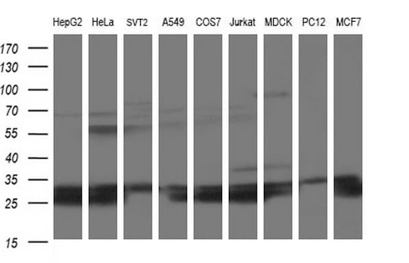 Monoclonal Mouse anti-Human HSCB Antibody (clone OTI3E1, IHC, WB)