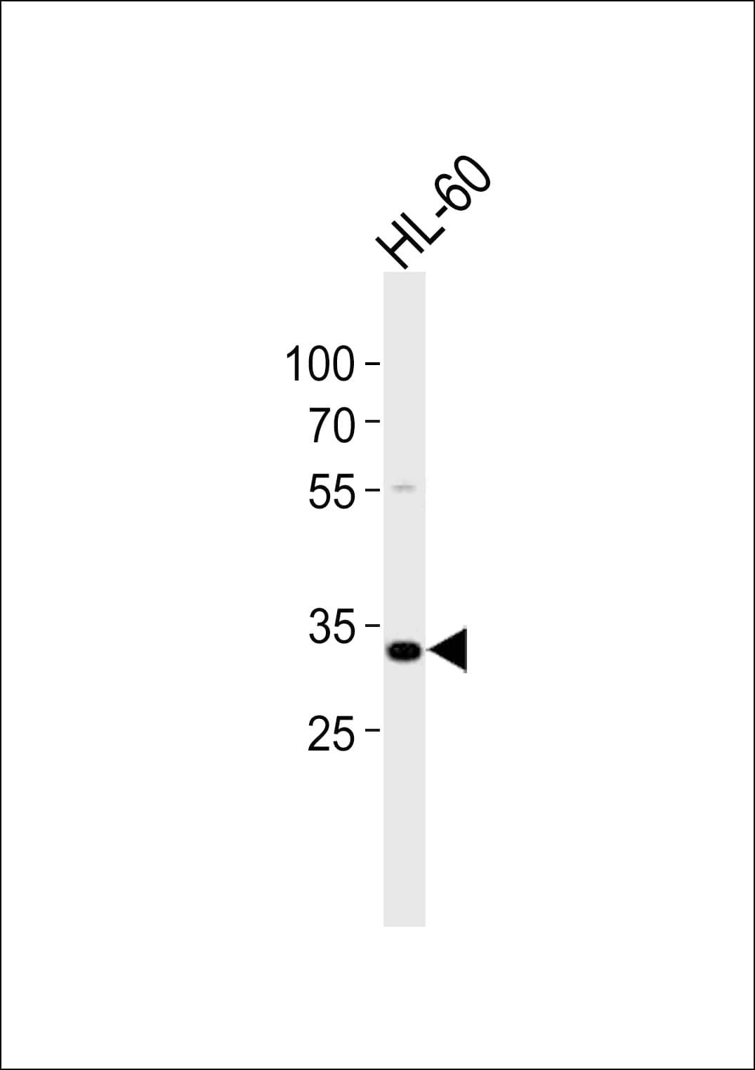 TREX2 Antibody (aa264-299)