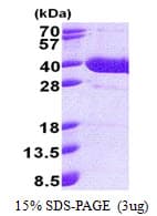 Human NFKBID / IkappaBNS Protein (Recombinant His)