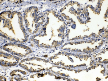 Polyclonal Rabbit anti-Human SOD3 Antibody (IHC)
