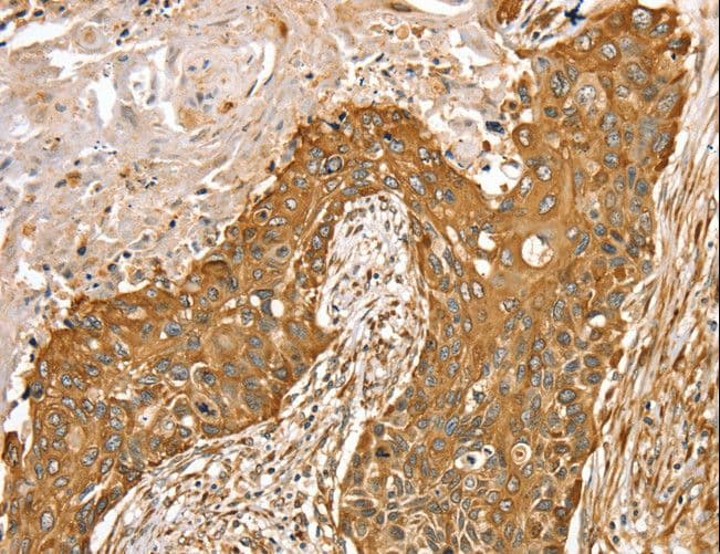 RASSF9 / P-CIP1 Antibody