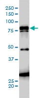 IHC-plus™ Monoclonal Mouse anti-Human JUP/CTNNG/Junction Plakoglobin Antibody (clone 2G9, IHC, IF, WB)
